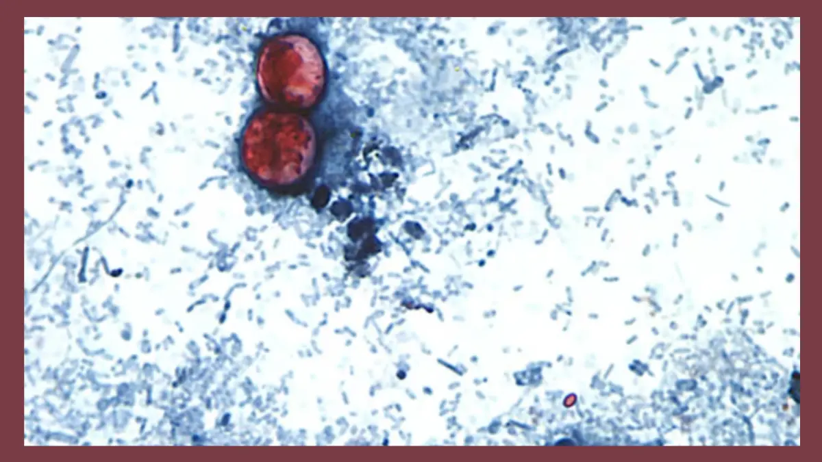 cyclosporiasis foods to avoid