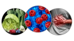 confirmed cyclosporiasis cases 48 states