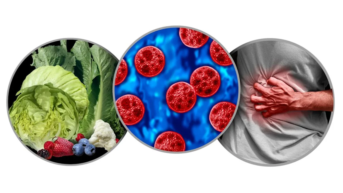confirmed cyclosporiasis cases 48 states